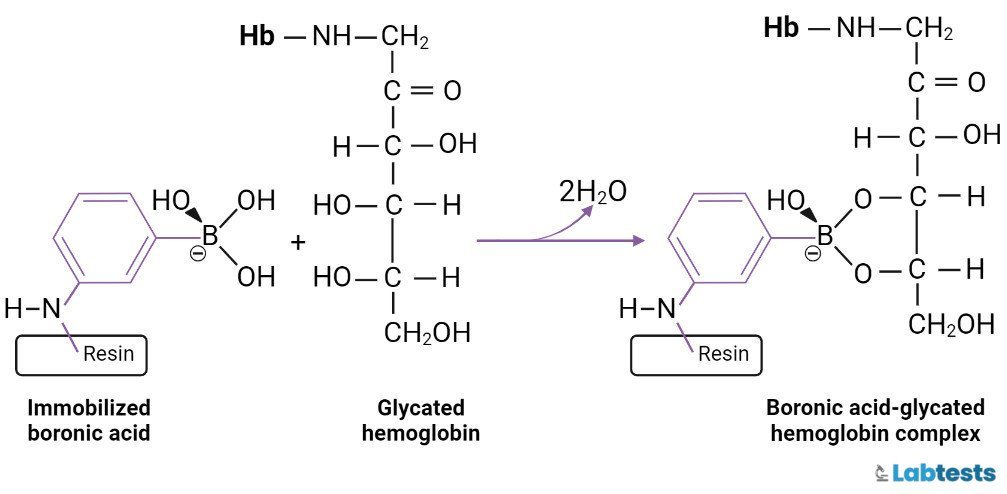 HbA1c test : Introduction, Normal Values, and Clinical Interpretation 4 chain Reaction of Glycated hemoglogbin (GHb) with immobilized acid