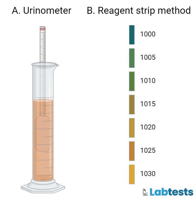 Reagent Strip Test of the Specific Gravity of Urine image