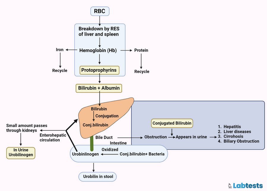 Urine Bilirubin Metabolism in flowchart image