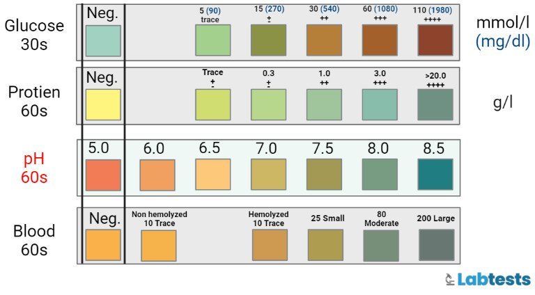 Urine Dipstick Method image