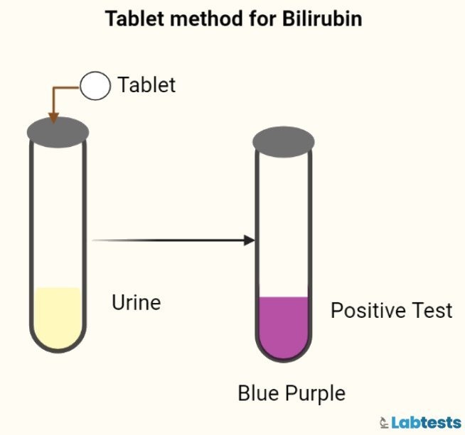 Urine bilirubin test tablet method