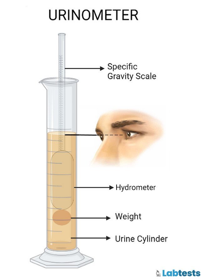 Urinometer